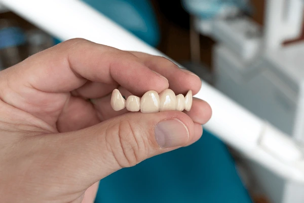 Fixed teeth in Nepal