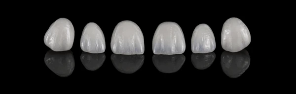 Teeth veneers price in nepal