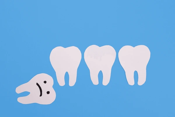 wisdom tooth removal price in Nepal 