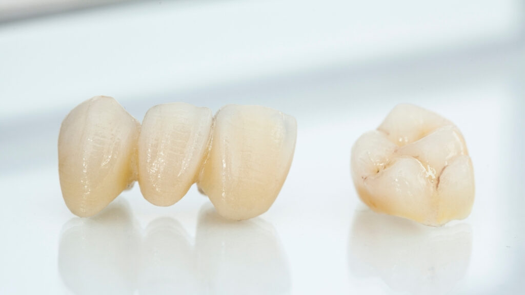 Zirconia crowns for front and back tooth in Nepal