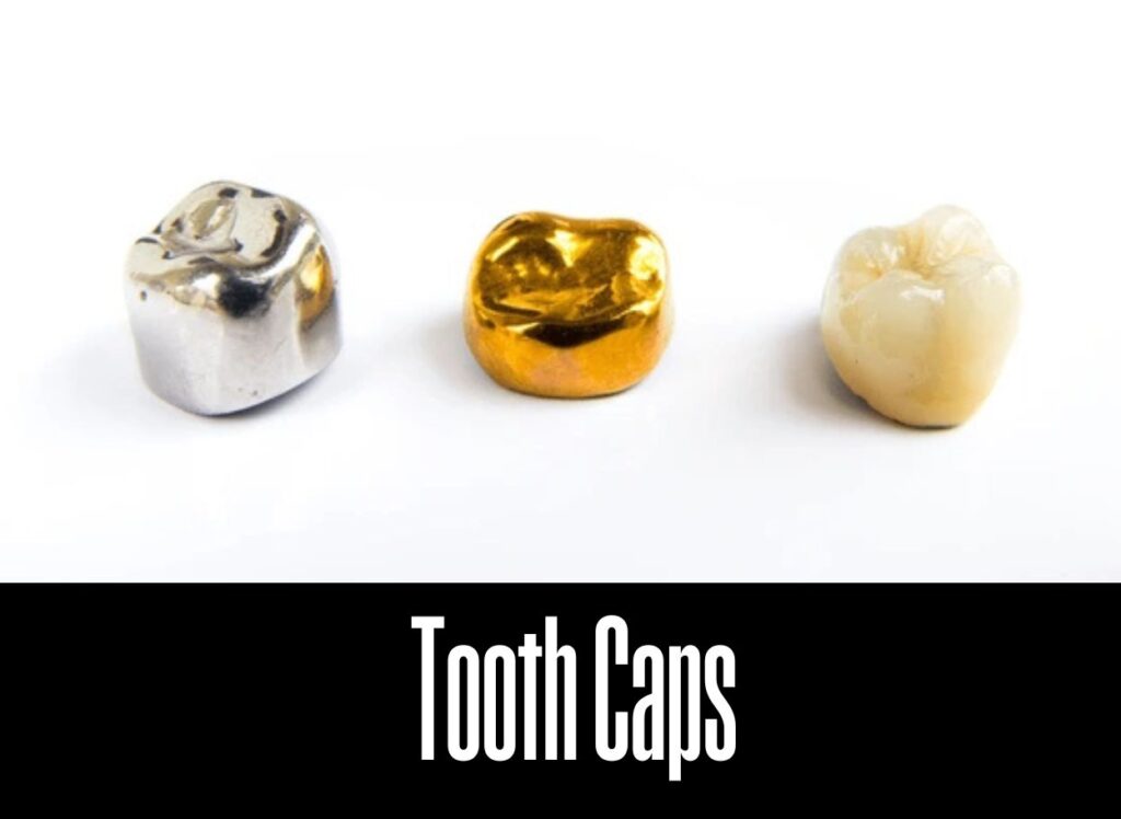 Cost of Dental Crown and Cost of RCT in Lalitpur