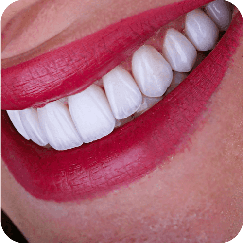 Full Mouth Rehabilitation