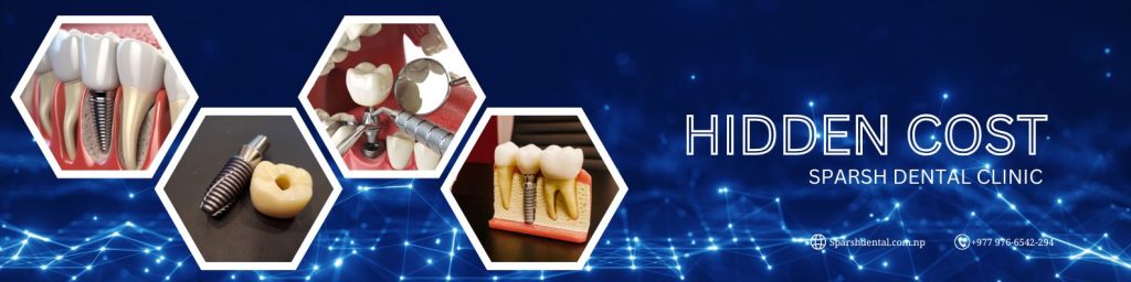 price of dental implant in lalitpur, Nepal