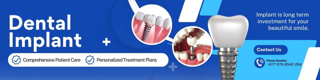 price of tooth implant in lalitpur