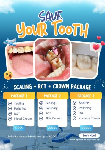 RCT  Crown Package